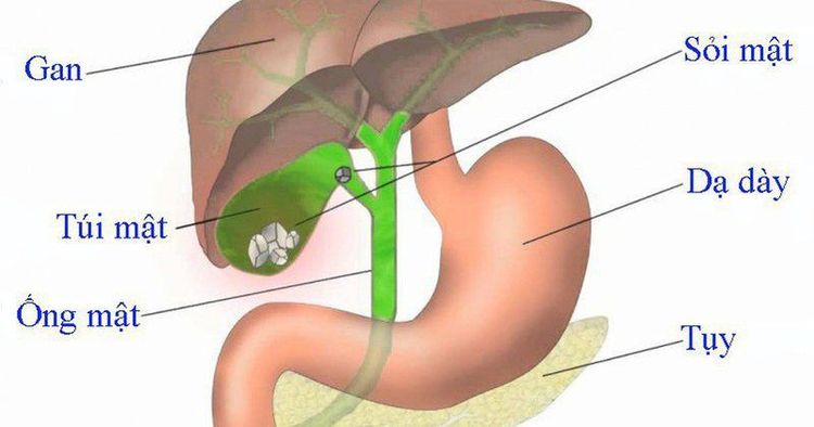 
Viêm tụy mạn có chữa được không?
