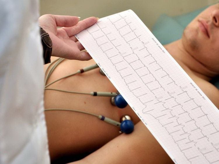 
Điện tâm đồ ECG
