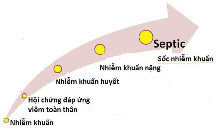 
Sốc nhiễm khuẩn là giai đoạn cuối, là biến chứng của nhiễm khuẩn qua các giai đoạn
