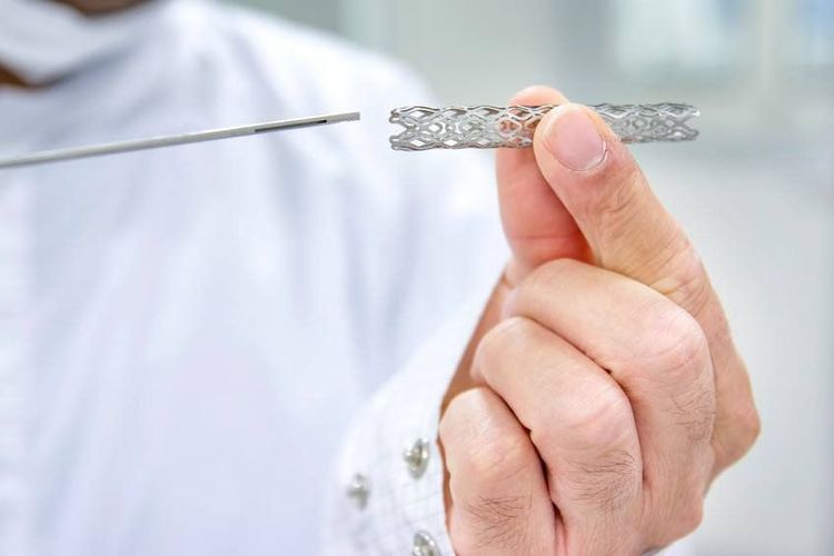 
Sử dụng stent để nong mạch vành qua da
