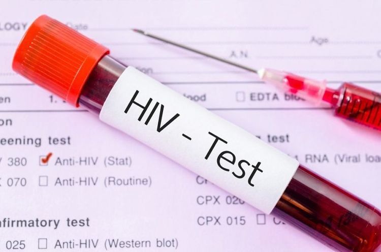 
Xét nghiệm máu để chẩn đoán HIV
