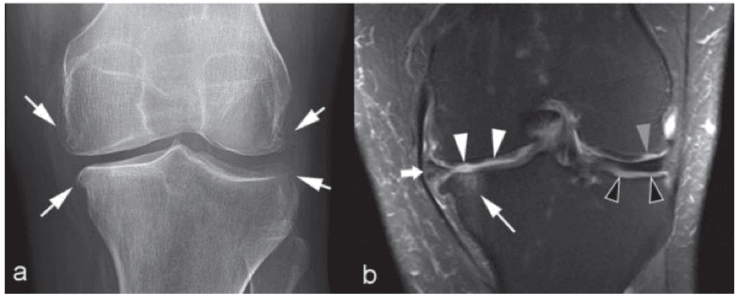 
Hình ảnh chụp MRI cơ xương độ phân giải cao
