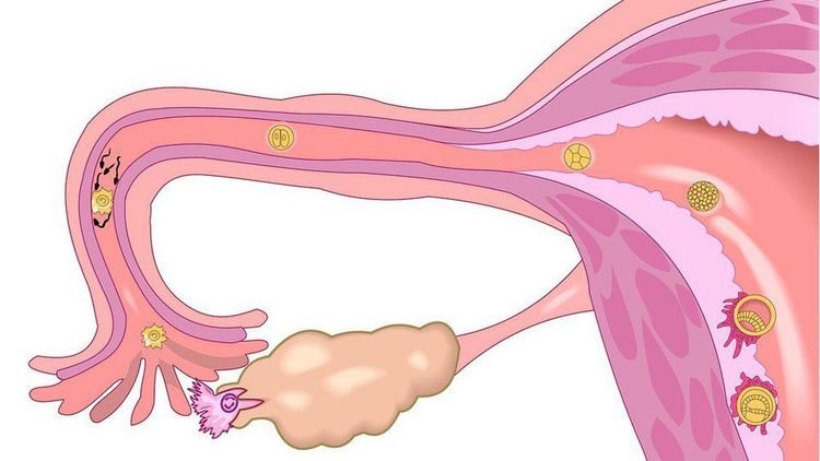 
Buồng trứng có vai trò quan trọng trong việc sinh sản ở phụ nữ
