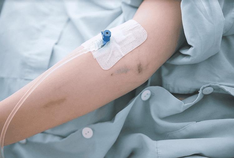 Bù dịch nhanh điều trị sốt xuất huyết Dengue
