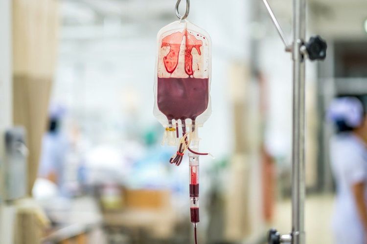 Truyền hồng cầu lắng khi bệnh nhân sốt xuất huyết Dengue có xuất huyết đi kèm