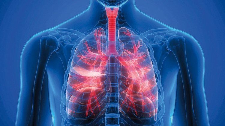 
Bệnh phổi tắc nghẽn mạn tính (COPD) đã gây ra những biến chứng nguy hiểm, đe dọa đến tính mạng người bệnh
