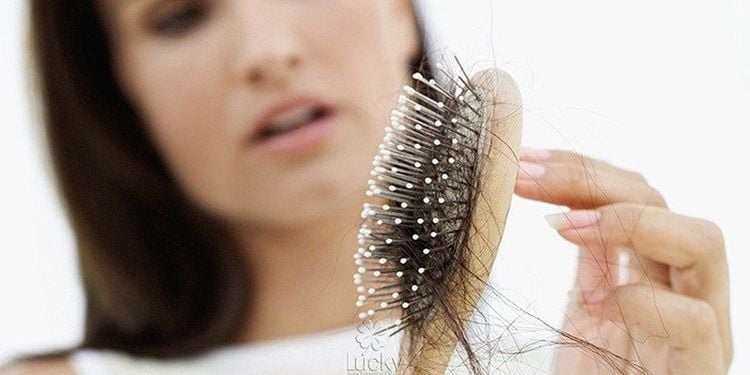 
Tóc rụng là triệu chứng báo hiệu nguy cơ thiếu kẽm trong cơ thể
