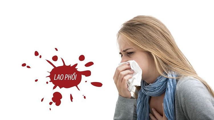 
Bệnh lao gây ra bởi vi khuẩn Mycobacterium tuberculosis
