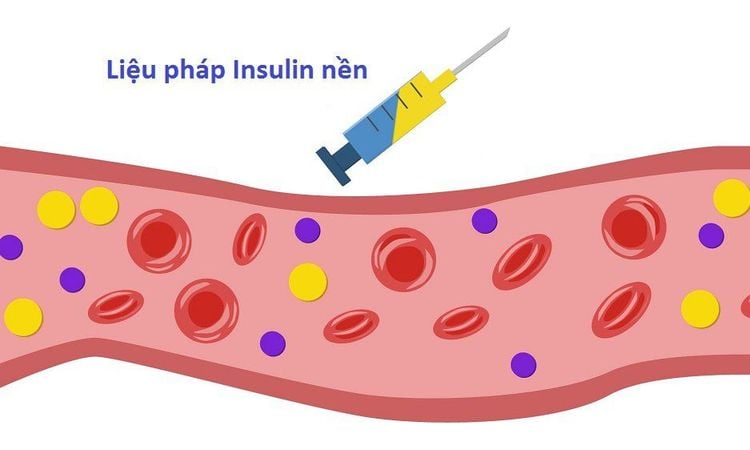 
Insulin được sử dụng điều trị bệnh tiểu đường
