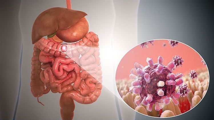 
Vi khuẩn Shigella là nguyên nhân gây viêm dạ dày ruột
