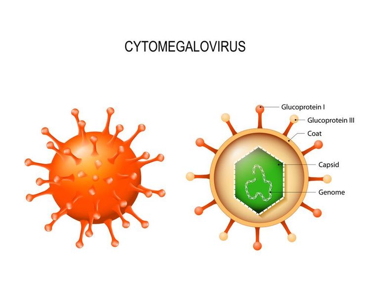 
Virus cytomegalo gây ra tình trạng nhiễm trùng không triệu chứng, do đó thường rất khó phát hiện bệnh
