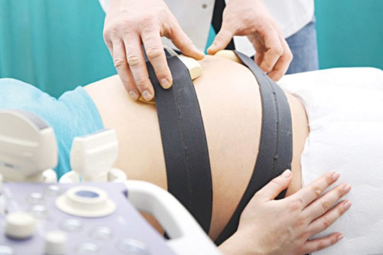 Theo dõi tình trạng thai nhi qua monitoring