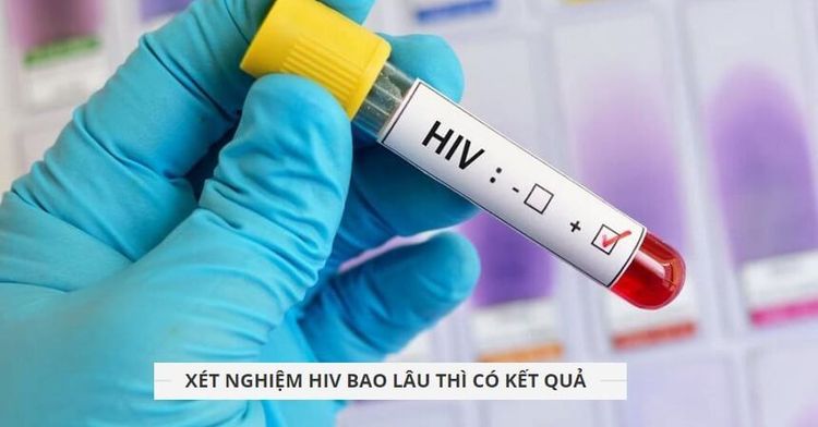 
Hầu như không thể phát hiện nhiễm HIV ngay lập tức
