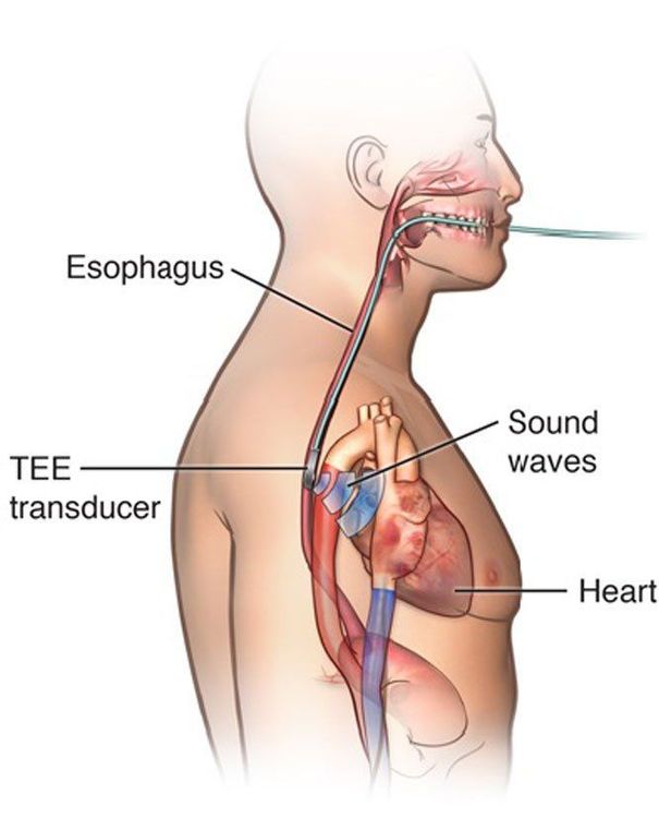 
Siêu âm tim qua thực quản
