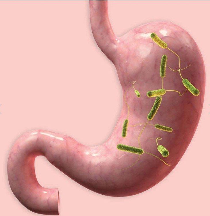 
H.Pylori sống ở lớp nhạy niêm mạc dạ dày
