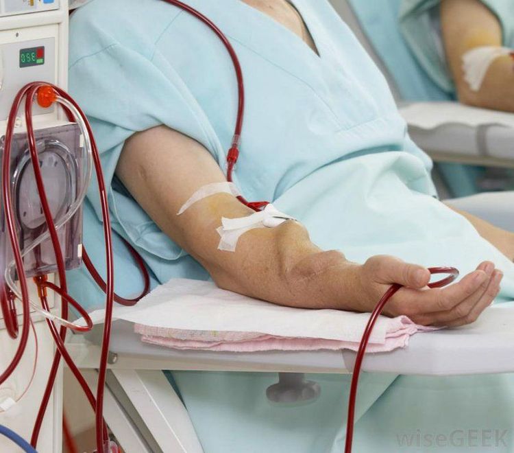 Trường hợp bệnh nhân đang đang chạy thận nhân tạo cần hạn chế phospho trong chế độ ăn