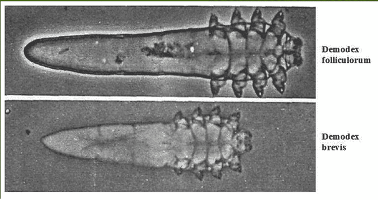 
Vi khuẩn demodex
