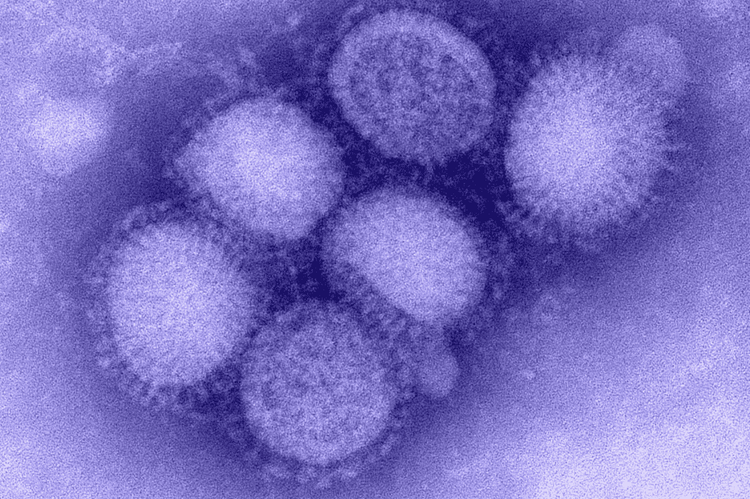 
Virus cúm A/H1N1
