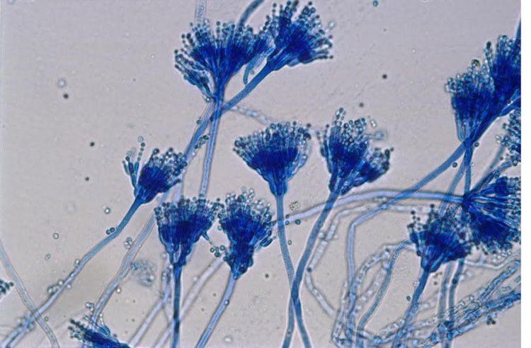 
Nấm Aspergillus gây bệnh ở phổi
