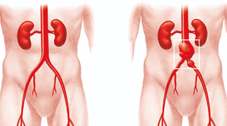 Động mạch chủ là động mạch lớn nhất của cơ thể