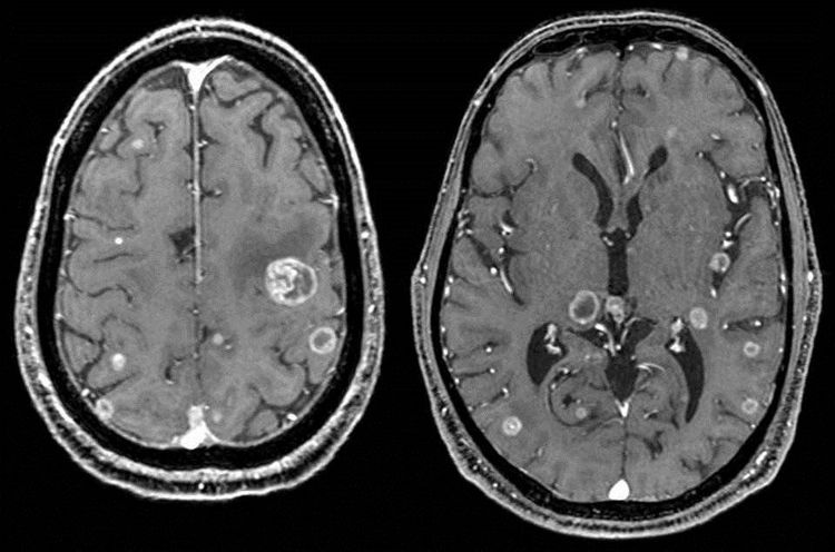 
Chụp MRI cho thấy những bất thường trong cơ thể như khối u
