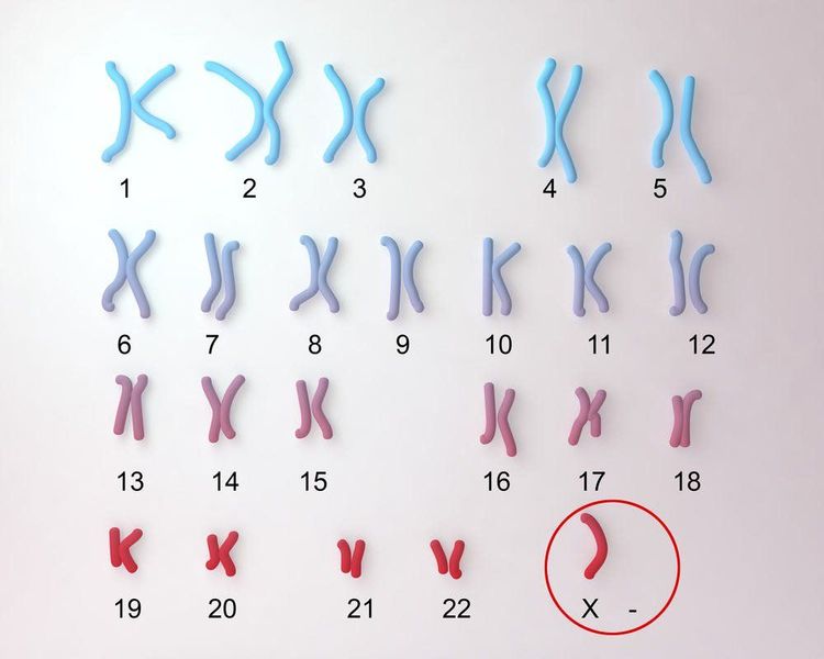 
Xét nghiệm Karyotype được chỉ định khi thành viên trong gia đình có rối loạn nhiễm sắc thể
