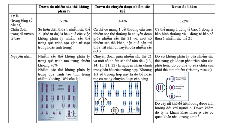 Phát hiện nguy cơ bệnh down ở thai nhi bằng xét nghiệm di truyền