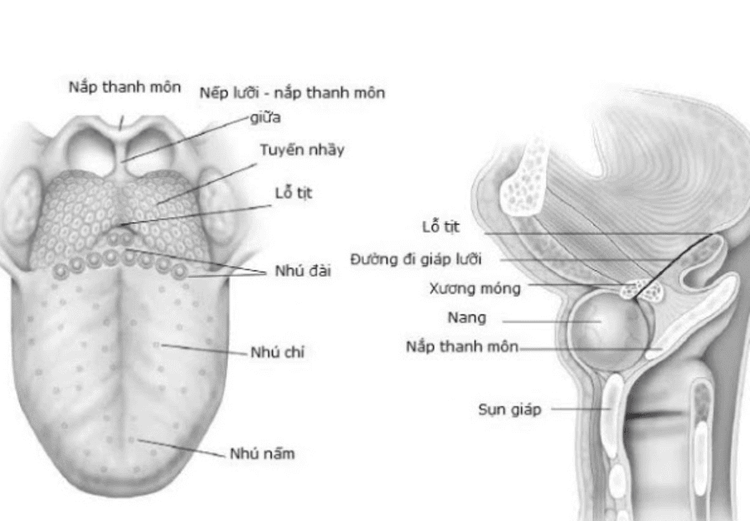 
U nang giáp móng làm xuất hiện các hạch ở cổ
