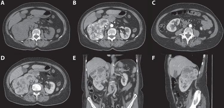 
Các lớp chụp CT Scanner thận - tiết niệu
