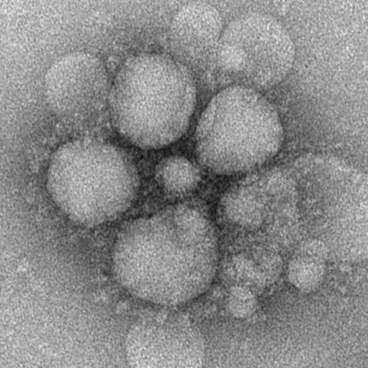 
Virus corona - MERS CoV
