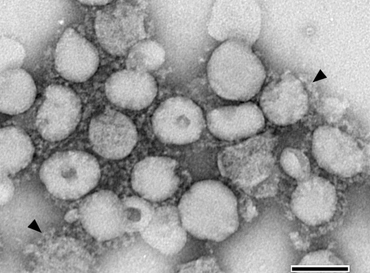 
Các coronavirus là một nhóm vi-rút có hình dạng quầng hoặc giống như vương miện (corona) khi nhìn dưới kính hiển vi
