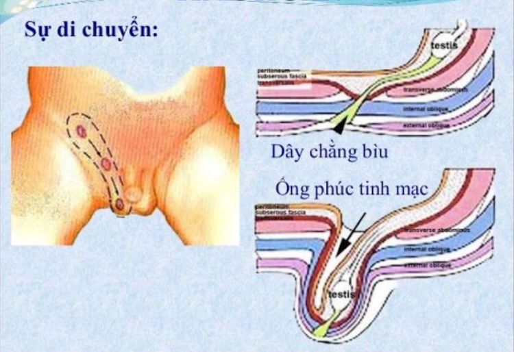 
Bệnh lý ống phúc tinh mạc
