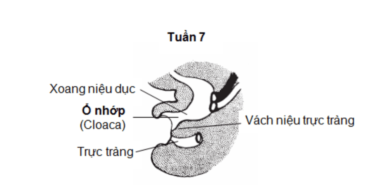 
Dị tật còn ổ nhớp tuần thứ 7 thai kỳ
