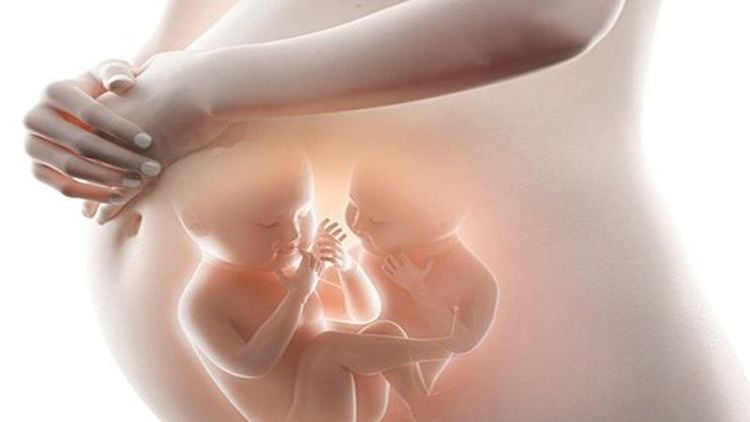 Phụ nữ mang đa thai làm tăng nguy cơ dây rốn một động mạch