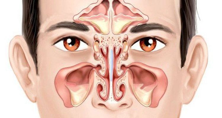 
The sinuses are located nearby and have openings into the nose
