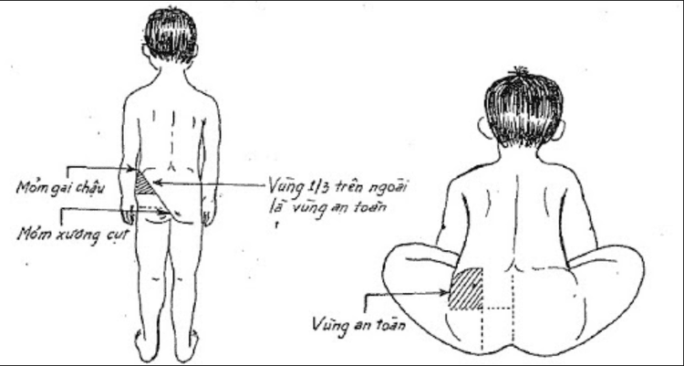 
Xác định vị trí tiêm mông
