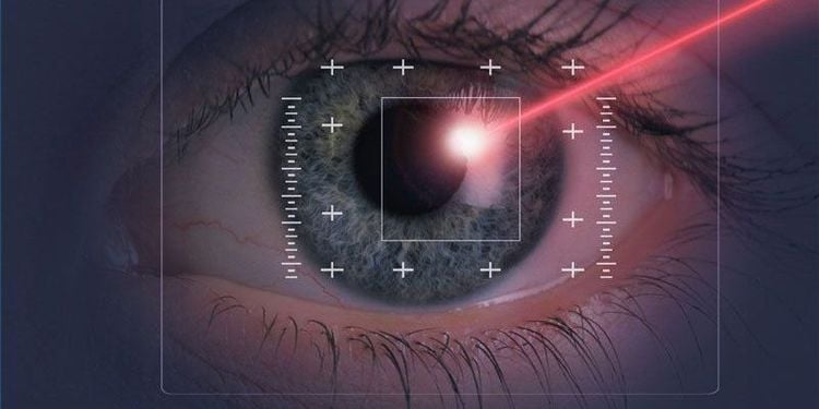 
Phẫu thuật giác mạc bằng lasik có thể làm mắt bị khô
