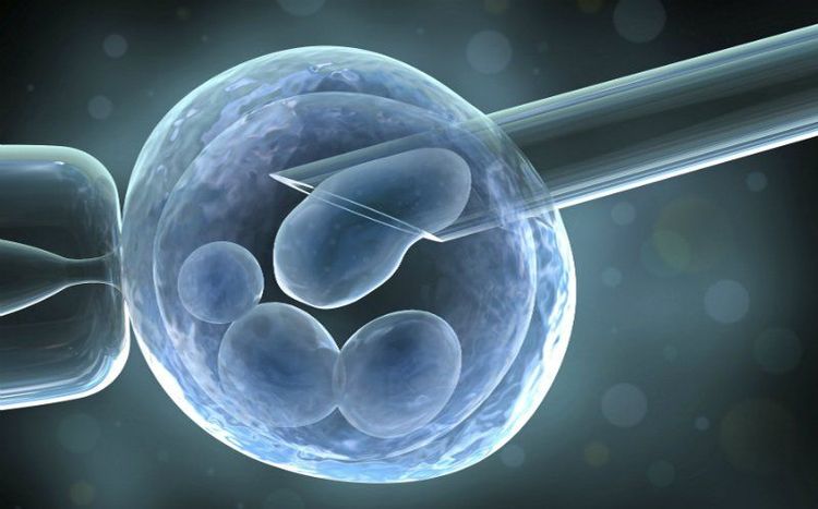 
Thụ tinh trong ống nghiệm (IVF) giúp điều trị vô sinh hiếm muộn
