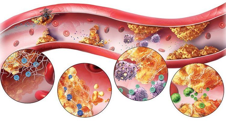 
Rosuvastatin được sử dụng trong bệnh lý mỡ máu
