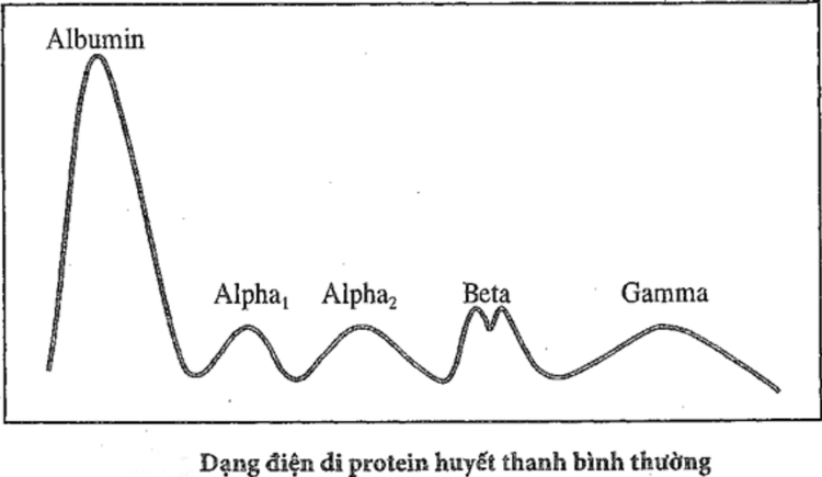 Significance of serum protein electrophoresis indicator