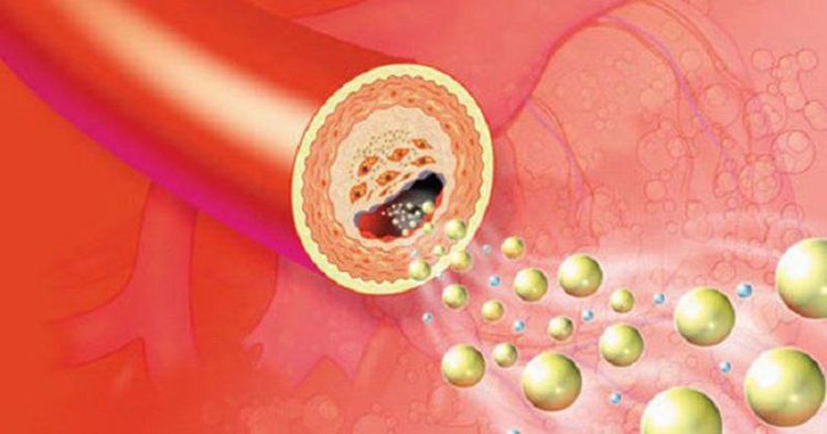 Virut viêm gan C có thể xâm nhập vào tế bào gan dưới dạng hạt giàu lipid