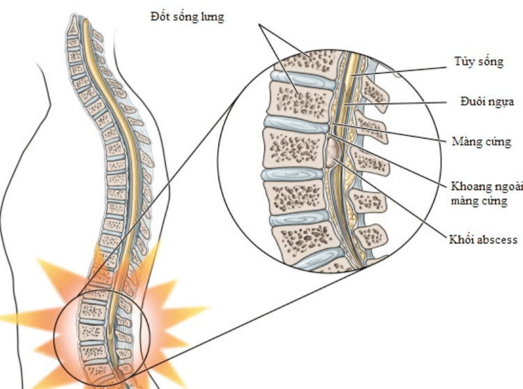 
Vị trí tủy sống trong ống sống
