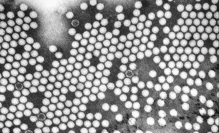 
Hình ảnh virus Polio gây bệnh bại liệt ở người
