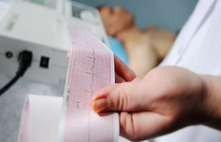 
Điện tâm đồ (ECG) là kỹ thuật chẩn đoán đo hoạt động điện của nhịp tim
