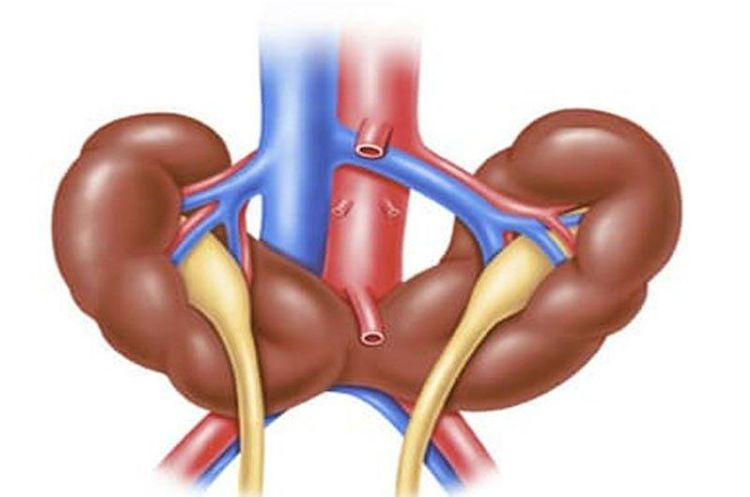 
Thận móng ngựa là một dị tật bẩm sinh
