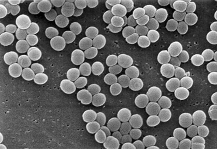 
Vi khuẩn staphylococcus aureus
