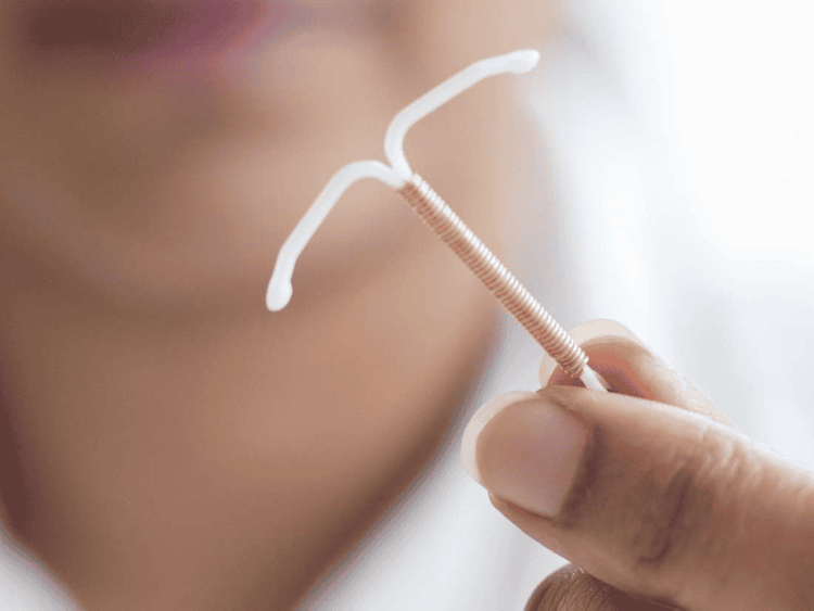 The IUD seems to have fewer side effects.