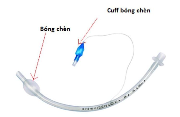 
Ống nội khí quản dùng để gây mê khi thực hiện nghiệm pháp nắm chặt bàn tay hay nâng đầu khỏi giường
