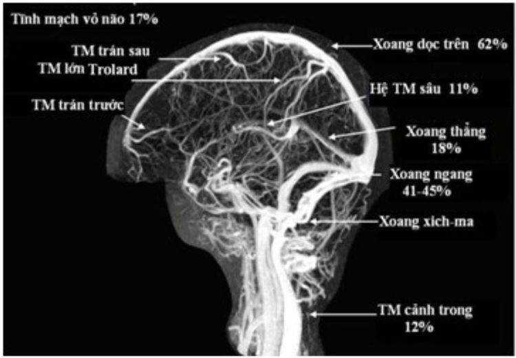 
Chụp cộng hưởng hệ tĩnh mạch não
