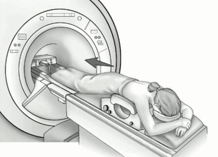 
Quy trình chụp MRI tuyến vú có thể kéo dài 30 phút
